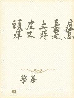 头皮上长痘痘又痒又疼是怎么回事