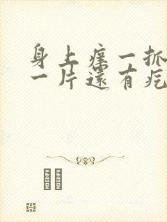 身上痒一抓就红一片还有疙瘩