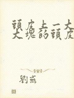 头皮上一大块一大块的头皮屑