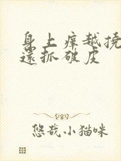 身上痒越挠越痒还抓破皮