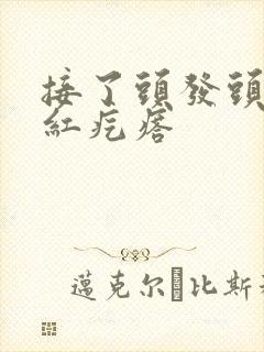 接了头发头皮起红疙瘩