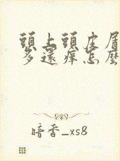 头上头皮屑特别多还痒怎么办封面