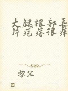 大腿根部长了一片疙瘩很痒