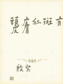 头皮红斑有白色皮屑