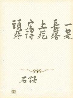 头皮上长一碰就疼得疙瘩是怎么回事