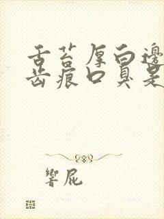 舌苔厚白边缘有齿痕口臭是怎么回事封面