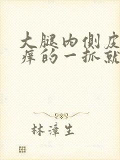 大腿内侧皮肤痒痒的一抓就更痒然后起疙瘩