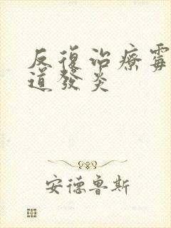 反复治疗霉菌阴道发炎