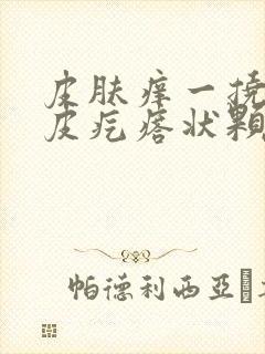 皮肤痒一挠起鸡皮疙瘩状颗粒