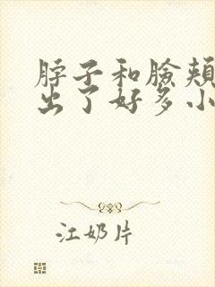 脖子和脸颊两侧出了好多小疙瘩很痒