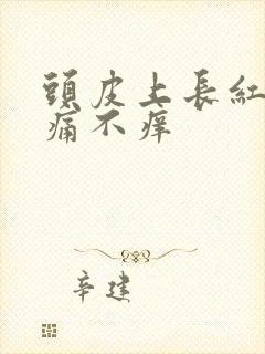 头皮上长红斑不痛不痒封面