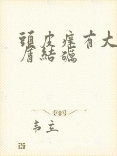 头皮痒有大块头屑结砺