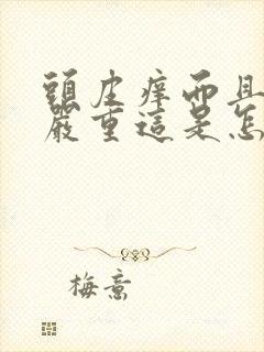 头皮痒而且掉发严重这是怎么回事