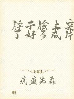 脖子脸上突然起了好多成片的小疙瘩很痒封面