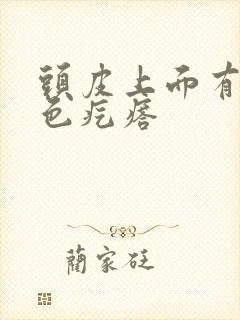 头皮上面有小红色疙瘩