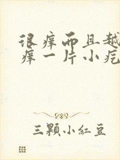 很痒而且越挠越痒一片小疙瘩封面