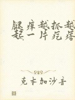 腿痒越抓越痒还起一片疙瘩