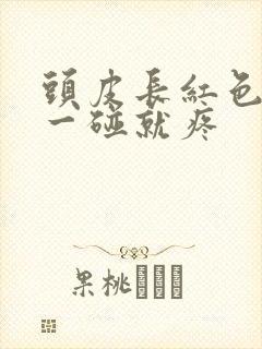 头皮长红色疙瘩一碰就疼封面