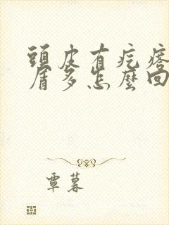 头皮有疙瘩头皮屑多怎么回事封面