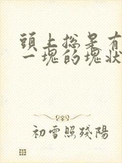 头上总是有一块一块的块状头皮屑