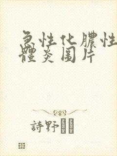 急性化脓性扁桃体炎图片