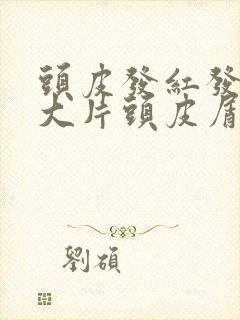 头皮发红发痒有大片头皮屑怎么办