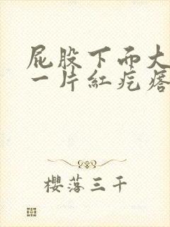 屁股下面大腿长一片红疙瘩