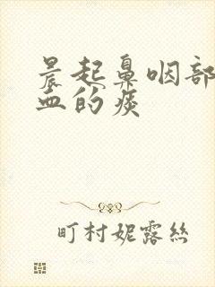 晨起鼻咽部有带血的痰