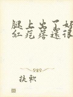 腿上出了好多小红疙瘩还很痒