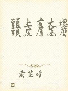 头上有大块白色头皮屑怎么回事封面