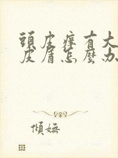 头皮痒有大量头皮屑怎么办