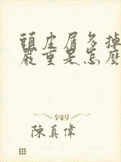 头皮屑多掉头发严重是怎么回事