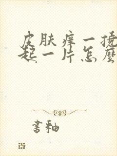 皮肤痒一挠就凸起一片怎么办