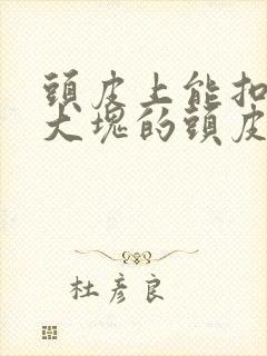 头皮上能扣下来大块的头皮屑