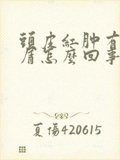 头皮红肿有头皮屑怎么回事封面