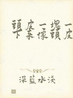 头皮一块一块抠下来像头皮屑