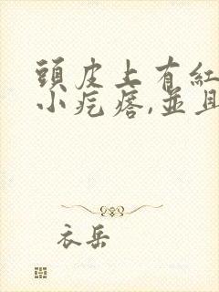 头皮上有红色的小疙瘩,并且有头皮屑