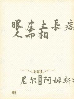 眼皮上长痣的女人面相