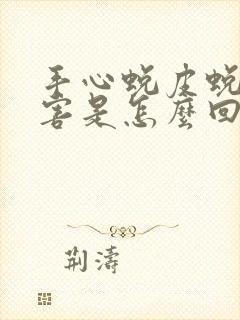 手心蜕皮蜕的厉害是怎么回事