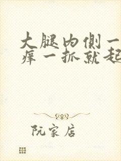 大腿内侧一热就痒一抓就起疙瘩封面