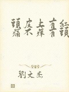 头皮上有红斑不痛不痒有头皮屑