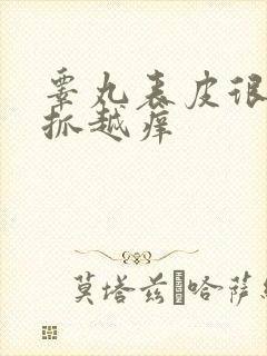 睾丸表皮很痒越抓越痒