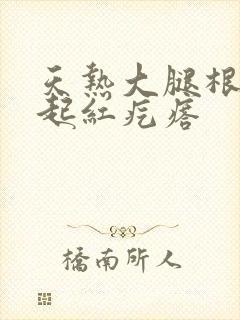 天热大腿根部痒起红疙瘩