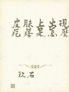 皮肤上出现小硬疙瘩是怎么回事