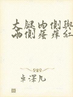 大腿内侧与阴囊两侧瘙痒红肿