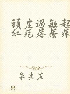 头皮过敏起一片红疙瘩瘙痒怎么办封面