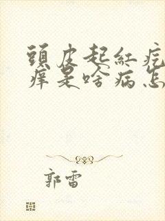 头皮起红疙瘩发痒是啥病怎么治疗