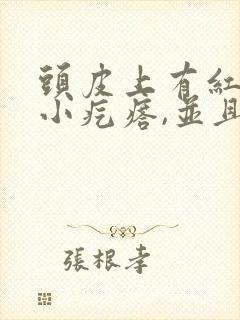 头皮上有红色的小疙瘩,并且有头皮屑