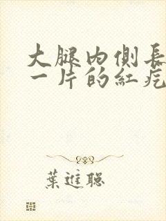 大腿内侧长一片一片的红疙瘩很痒