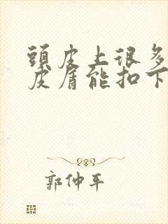 头皮上很多大头皮屑能扣下来